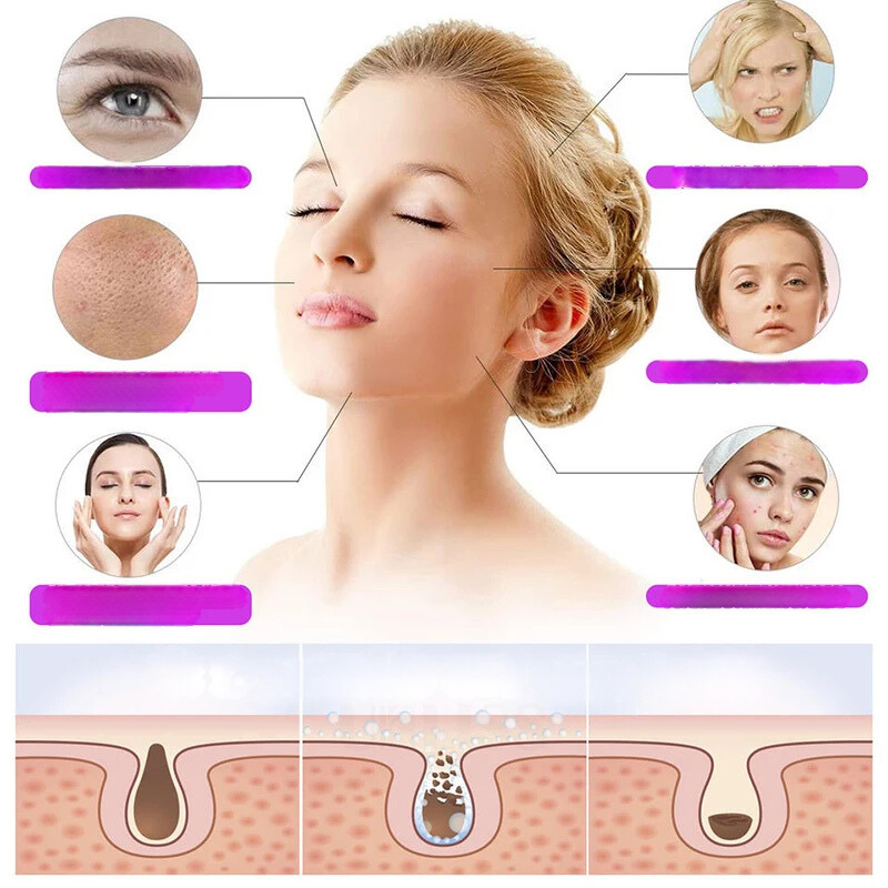 LumiThera - High-Frequency Skin & Eye Care Wand with Ozone Technology-2