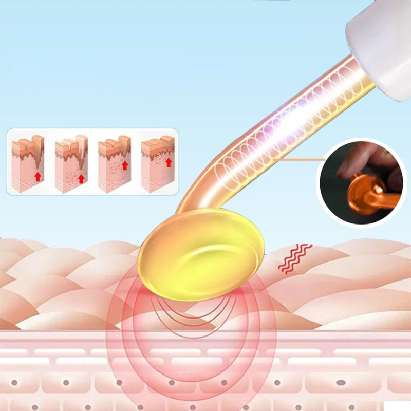 GlowWave - High-Frequency Electrode Wand for Skin Tightening & Wrinkle Removal-4