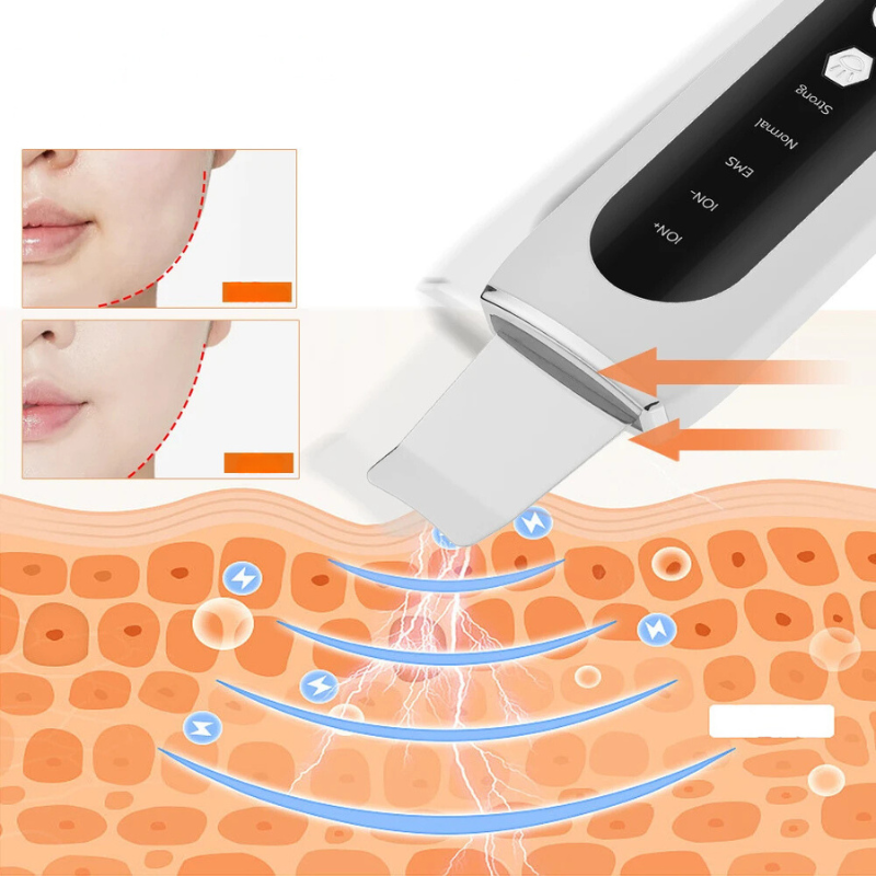 RadiantGlow - Facial Pore Cleanser & Blackhead Remover-4