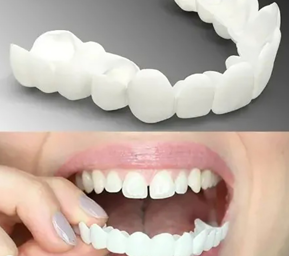 Adjustable Snap-On Dentures 2