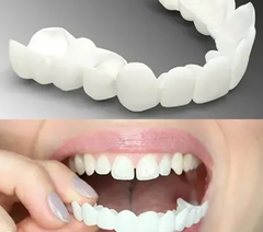 Adjustable Snap-On Dentures 2