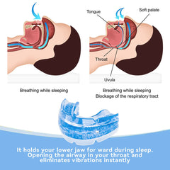 Adjustable anti-snoring mouthpiece 2
