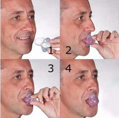 Apnea Tongue Stabilizing Device 2
