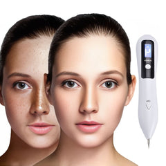 ClearSkinPro Laser Plasma Pen - Non-Invasive | for Freckle, Skin Tag, Spot, Mole and Tattoo Removal at Home 3