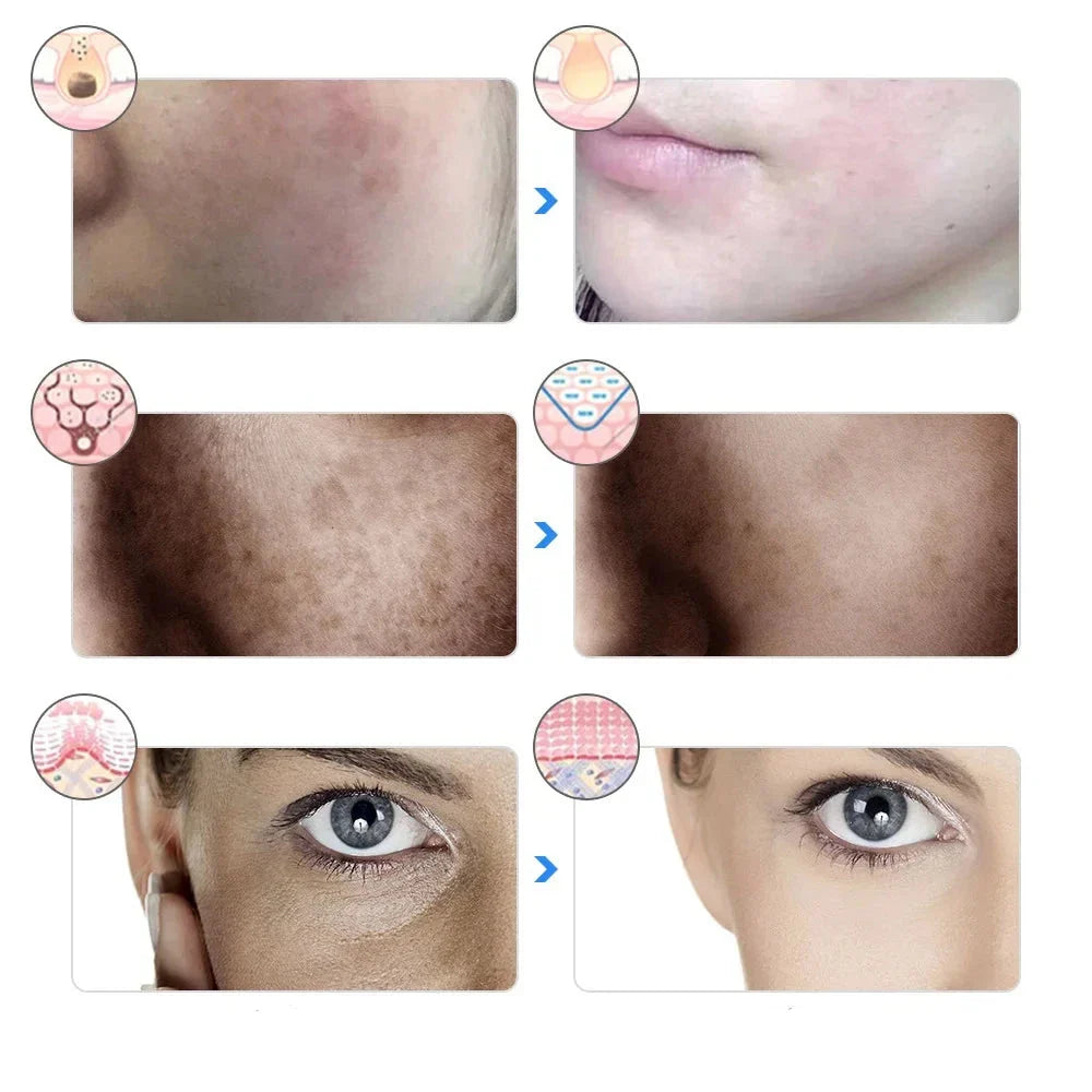 AgeGlow - 7-Color LED Therapy Mask for Facial Lifting & Whitening-5