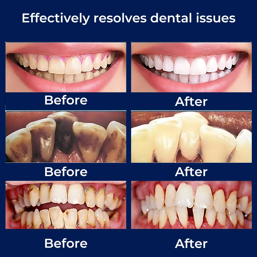 PlaqueFree Plaque Remover for teeth | Ultrasonic Teeth Cleaner - Tartar Remover from Home - Deep Teeth Cleaning and Polish 2