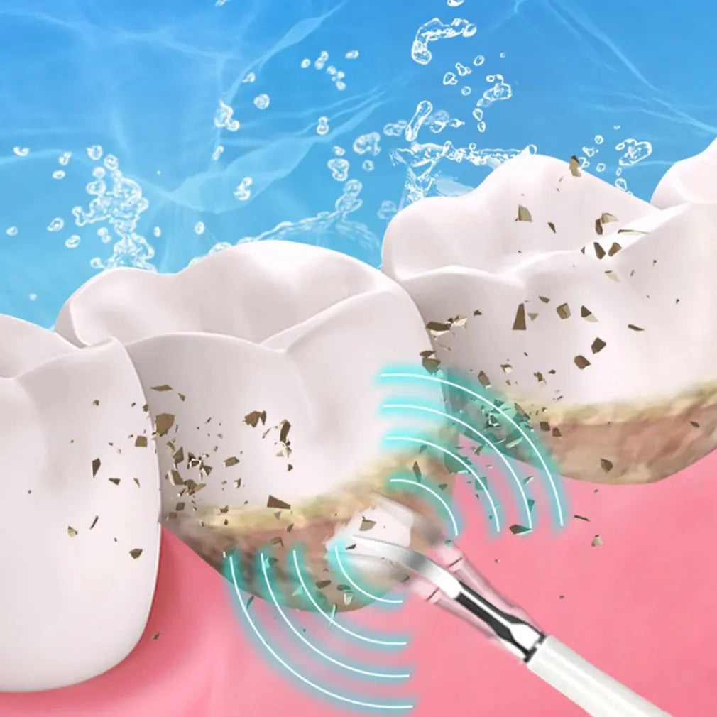SparkSonic - Sonic Dental Cleaner & Whitening Irrigator-3