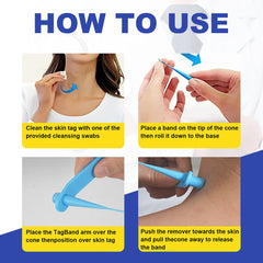 Skin Tag Removal Kit - 2-in-1 Silicone Band Ligation System for Safe Home Use-4