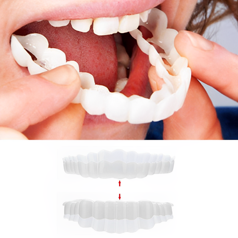 Smile Veneer (Upper & Lower Included) 0