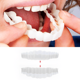 Smile Veneer (Upper & Lower Included) 0