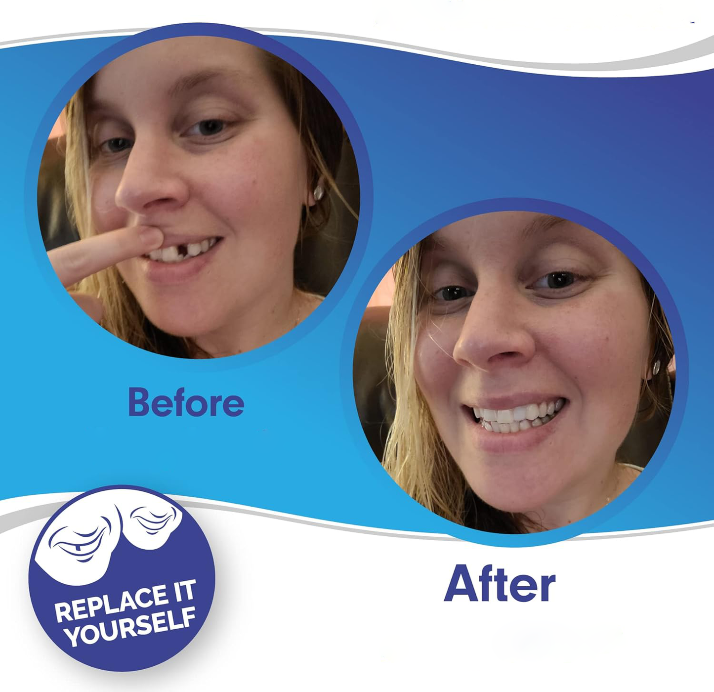 Smile Veneer (Upper & Lower Included) 2