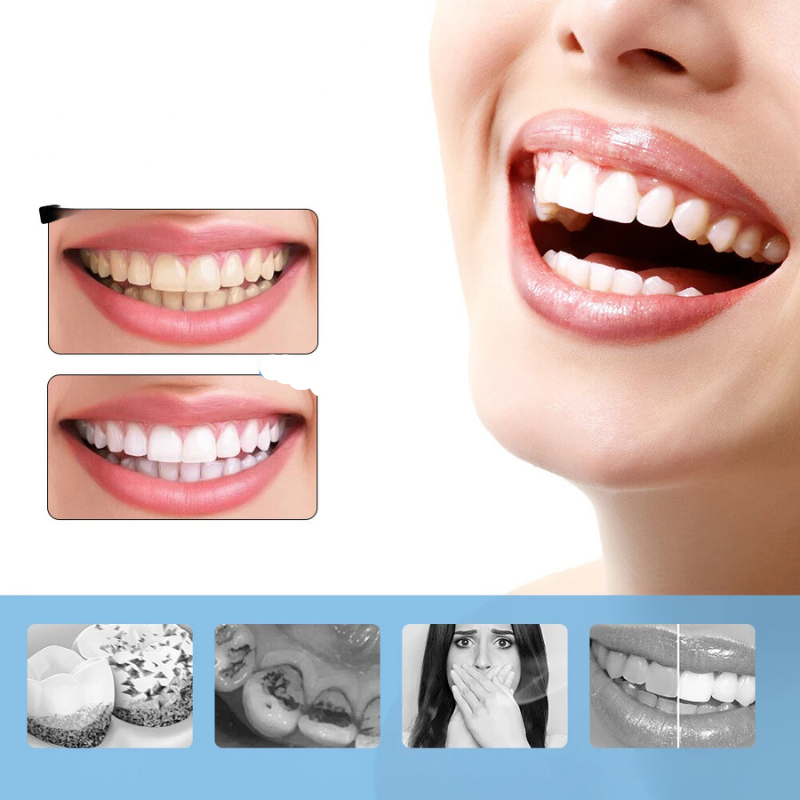 FreshWhite - 6-Speed Electric Teeth Whitening & Scaler-2