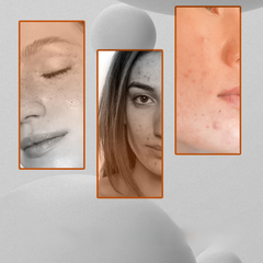 Spotless Glow Toner – Dark Spot Corrector & Brightening Face Care-3