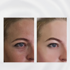 RadiantRoll - Stainless Steel Skin Tightening Tool-2