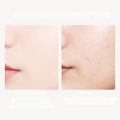 24K Gold Anti-Aging Toner – Hydrate & Refresh for Youthful, Acne-Free Skin-2