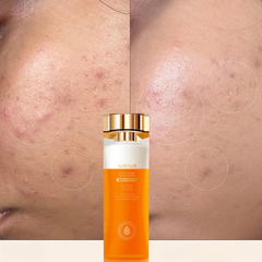 CollagenGlow Firming Essence – Skin Renewal & Anti-Aging Tone-4