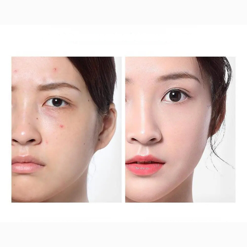 ClearSkin Ampoule Toner – Acne Care & Moisturizing Serum-3