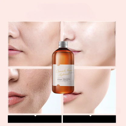 RoseHydra Mist - Nourishing Rose Water Toner for Dry Skin Care-3