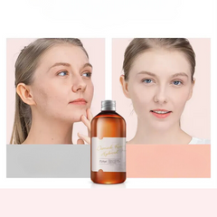 RoseHydra Mist - Nourishing Rose Water Toner for Dry Skin Care-2