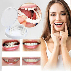 Instant smile transformation with Snap on Smile Veneers 1