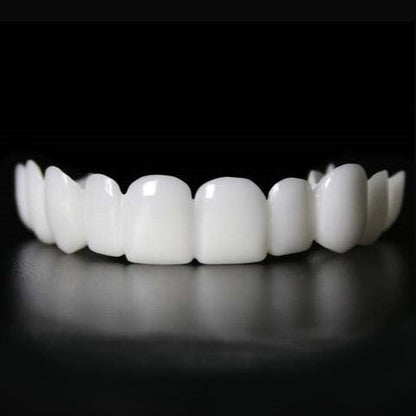 Instant smile transformation with Snap on Smile Veneers 2