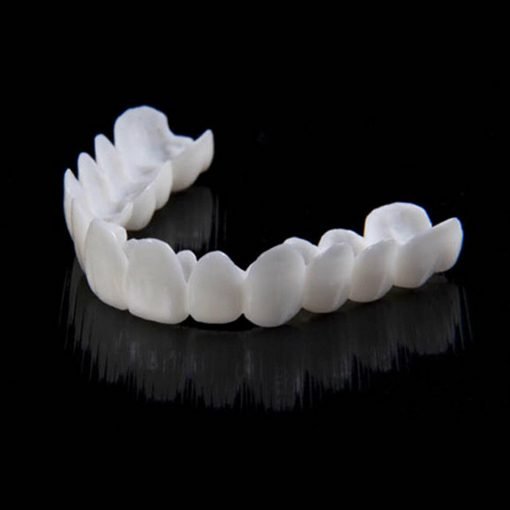 Instant smile transformation with Snap on Smile Veneers 3