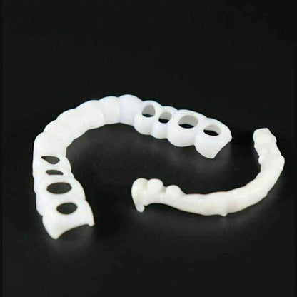 Instant smile transformation with Snap on Smile Veneers 4