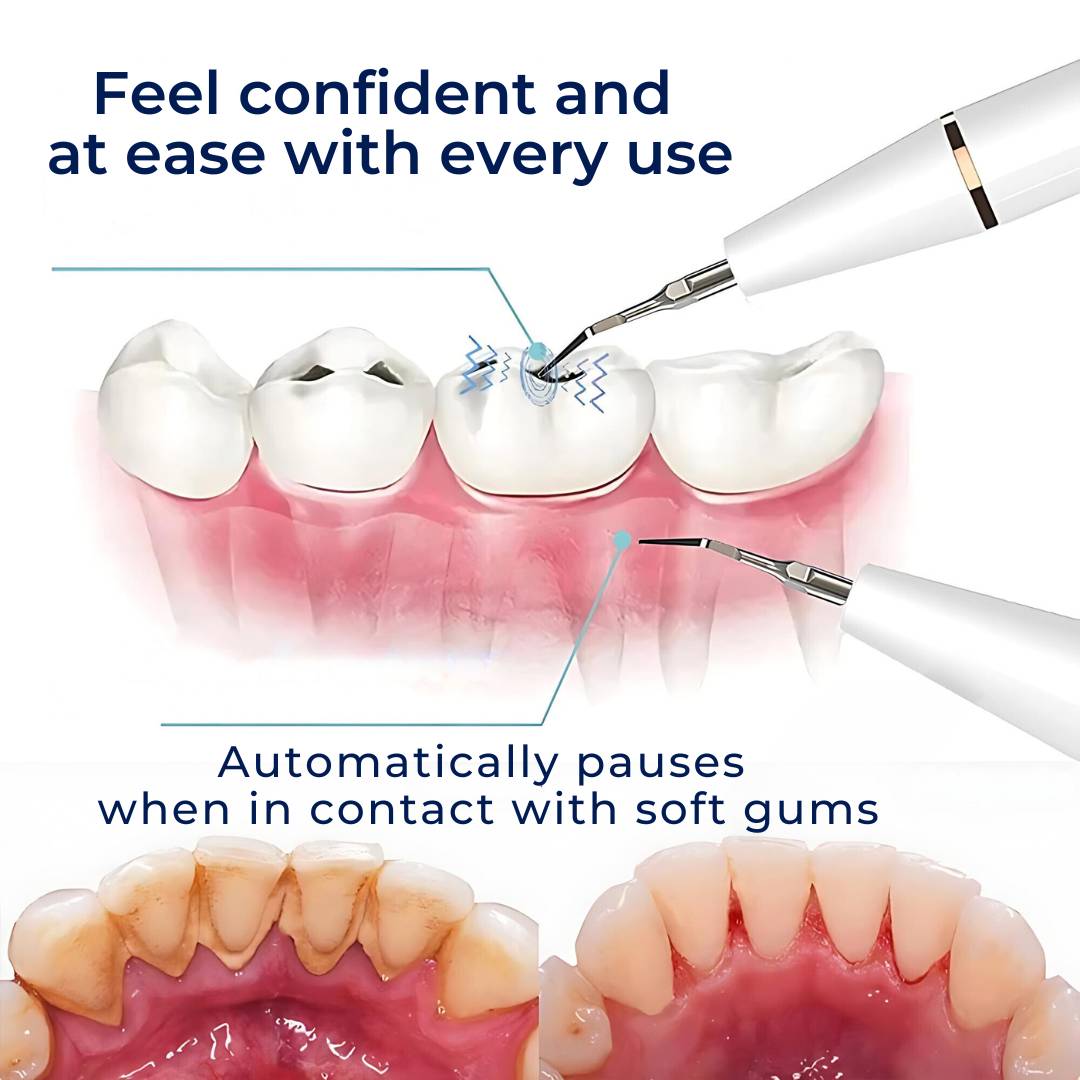 PlaqueFree Plaque Remover for teeth | Ultrasonic Teeth Cleaner - Tartar Remover from Home - Deep Teeth Cleaning and Polish 6