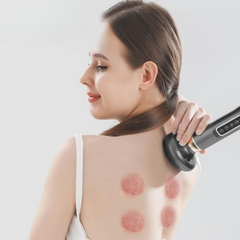RevitaLuxe | Adjustable Electric Cupping Therapy Massager for Pain Relief 1