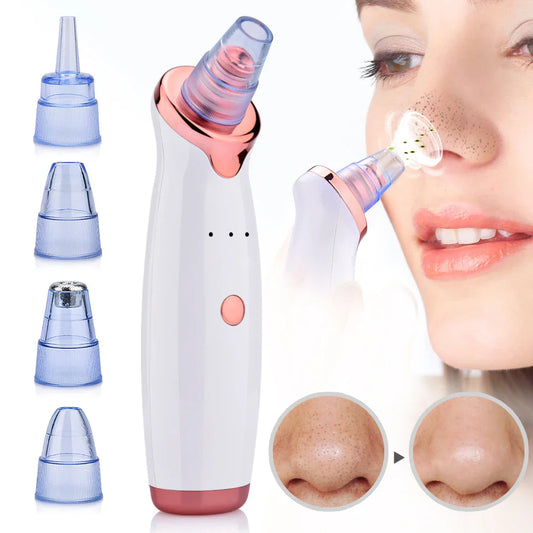 GlowClean - Blackhead & Acne Vacuum Tool-1