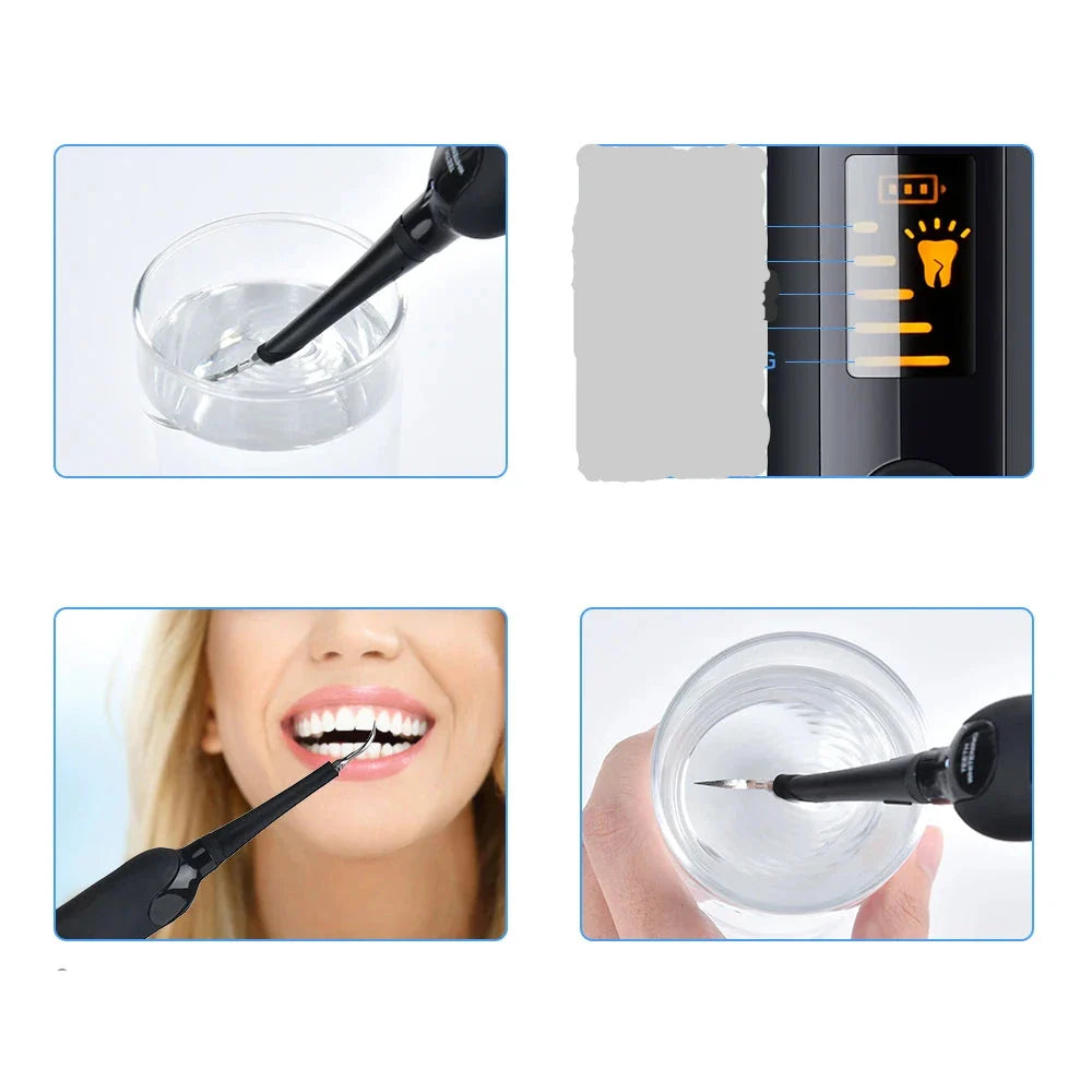 WhiteSpark - Wireless Waterproof Dental Scaler & Teeth Cleaner-2