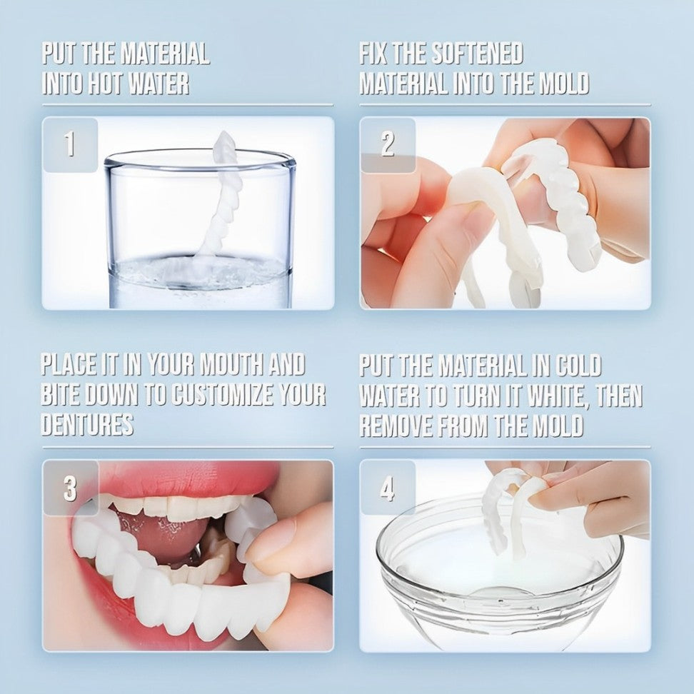 Smile Veneer (Upper & Lower Included) 6